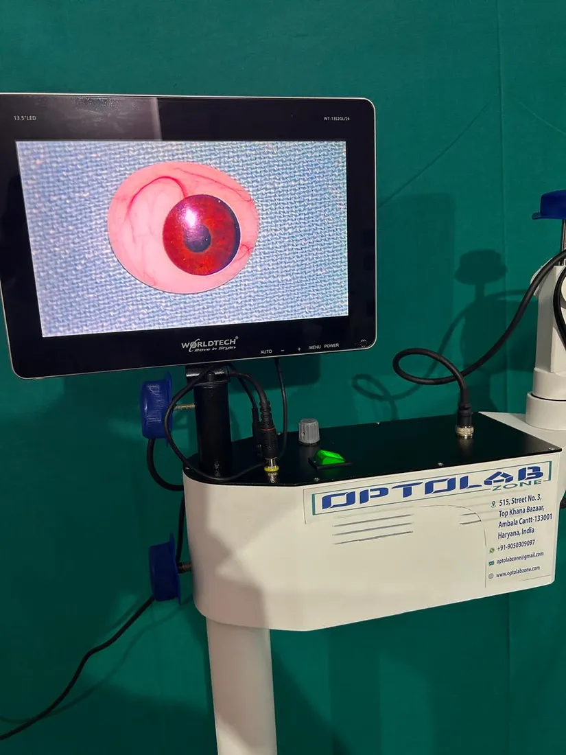 Ophthalmic Surgical Microscope — view 2 of 6